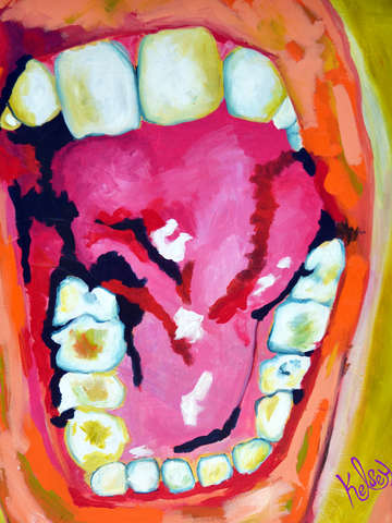 Open wide