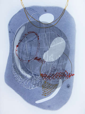 Plastiglomerate cytology 4