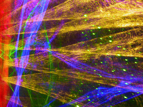 Laser 2