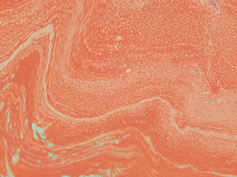 Corpuscles