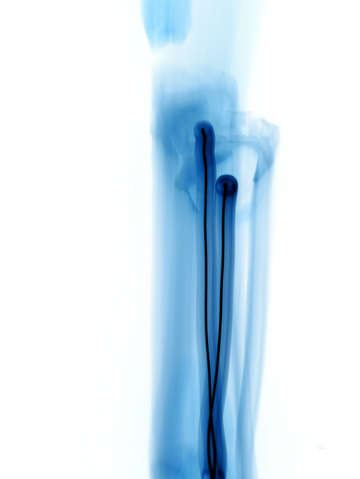 Trace 001