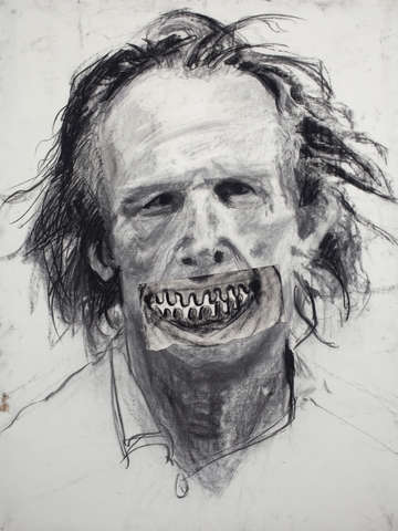 Nick nolte with gingivitis
