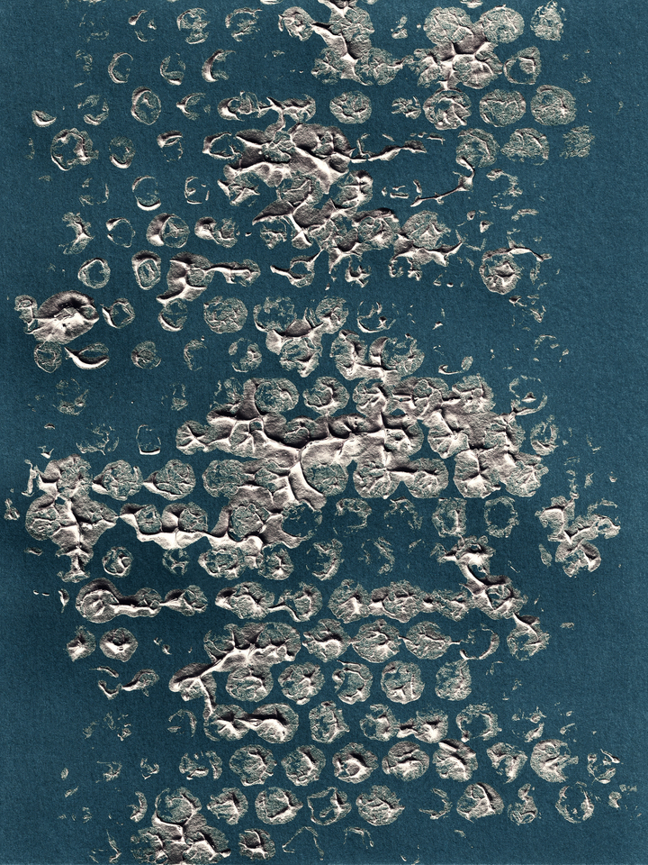 BLOTS AND DOTS 2 METALLIC SILVER DARK TEAL ABSTRACT PATTERN (DIPTYCH)